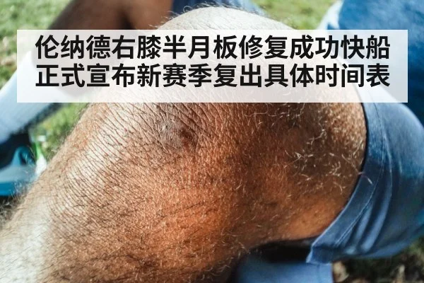 伦纳德右膝半月板修复成功快船正式宣布新赛季复出具体时间表